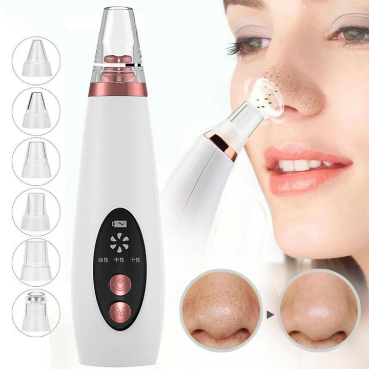 USB Blackhead & Black Dot Remover
