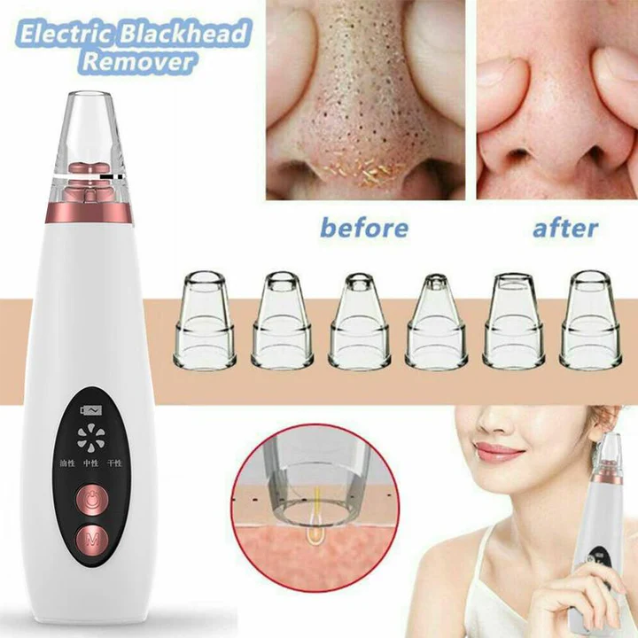 USB Blackhead & Black Dot Remover